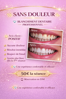 Milaya Beautyy/ Blanchiment Dentaire